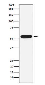 WASP Recombinant Rabbit Monoclonal Antibody
