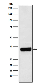 PRKRA Recombinant Rabbit Monoclonal Antibody