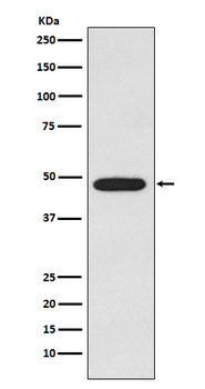 Galactosidase alpha Recombinant Rabbit Monoclonal Antibody