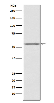 AMHR2 Recombinant Rabbit Monoclonal Antibody