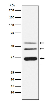 Legumain Recombinant Rabbit Monoclonal Antibody