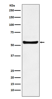 PAR-2 Recombinant Rabbit Monoclonal Antibody