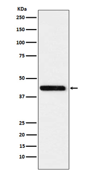 CTH Recombinant Rabbit Monoclonal Antibody