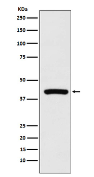 PPID Recombinant Rabbit Monoclonal Antibody