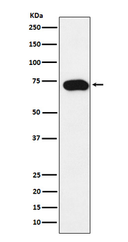 SLC22A1 Recombinant Rabbit Monoclonal Antibody