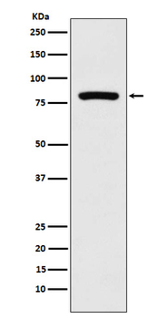 KIF2C Recombinant Rabbit Monoclonal Antibody
