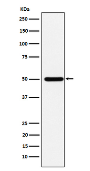 ABAT Recombinant Rabbit Monoclonal Antibody