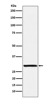 ACRV1 Recombinant Rabbit Monoclonal Antibody
