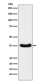 AKR1C3 Recombinant Rabbit Monoclonal Antibody