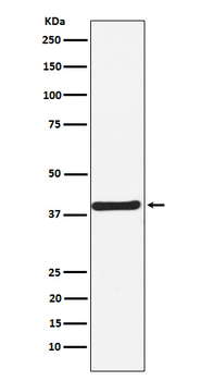 CaMKI Recombinant Rabbit Monoclonal Antibody