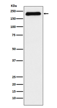 ATAD2 Recombinant Rabbit Monoclonal Antibody