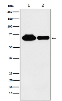 METTL3 Recombinant Rabbit Monoclonal Antibody