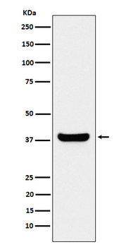 PP-1B Recombinant Rabbit Monoclonal Antibody
