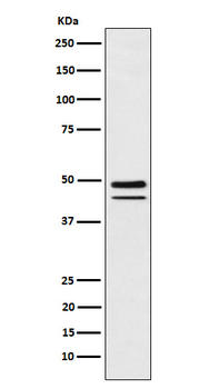 Brachyury Recombinant Rabbit Monoclonal Antibody