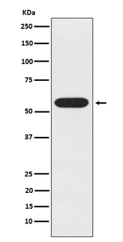UAP1 Recombinant Rabbit Monoclonal Antibody