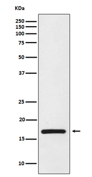 HMGA1 Recombinant Rabbit Monoclonal Antibody