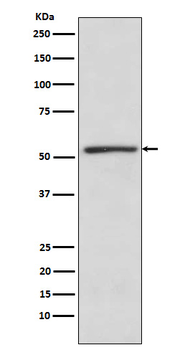 TBL1XR1 Recombinant Rabbit Monoclonal Antibody