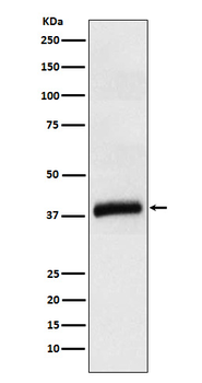 APOL1 Recombinant Rabbit Monoclonal Antibody
