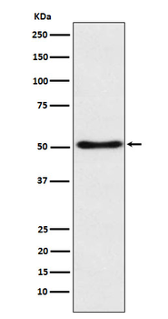 SFRP4 Recombinant Rabbit Monoclonal Antibody