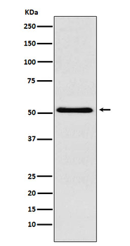 SMARCE1 Recombinant Rabbit Monoclonal Antibody