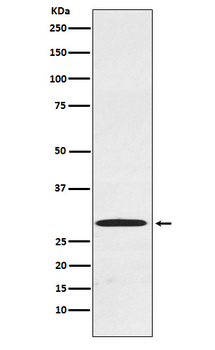CDX1 Recombinant Rabbit Monoclonal Antibody