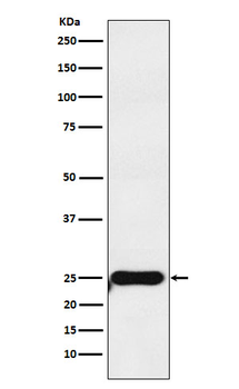COMT Recombinant Rabbit Monoclonal Antibody