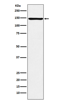 ORP150 Recombinant Rabbit Monoclonal Antibody