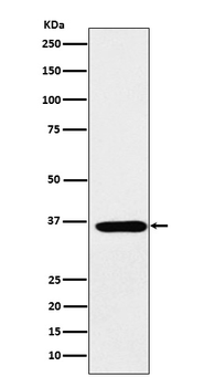 SMN1 Recombinant Rabbit Monoclonal Antibody
