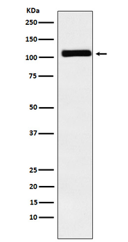 MIB1 Recombinant Rabbit Monoclonal Antibody