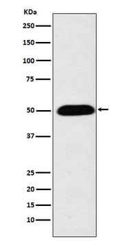 CYP27A1 Recombinant Rabbit Monoclonal Antibody