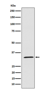 UCP1/3 Recombinant Rabbit Monoclonal Antibody