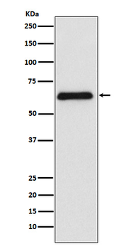 PARP2 Recombinant Rabbit Monoclonal Antibody