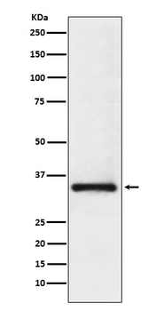 U1A Recombinant Rabbit Monoclonal Antibody