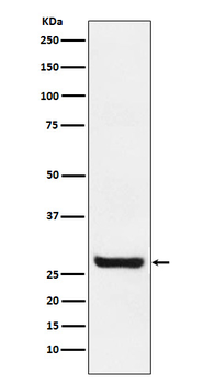 Sprouty 4 Recombinant Rabbit Monoclonal Antibody