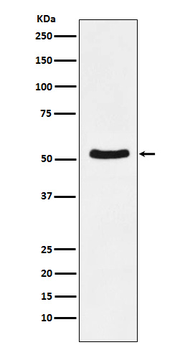 DDX6 Recombinant Rabbit Monoclonal Antibody