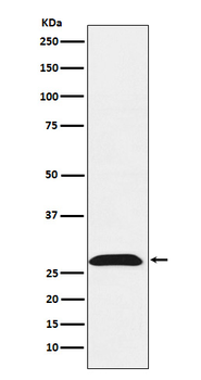 RhoGDI 1 Recombinant Rabbit Monoclonal Antibody