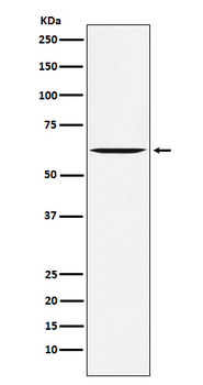 YES1 Recombinant Rabbit Monoclonal Antibody