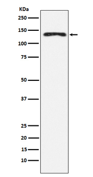 NEDD4 Recombinant Rabbit Monoclonal Antibody