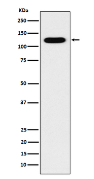 Cadherin 16 Recombinant Rabbit Monoclonal Antibody