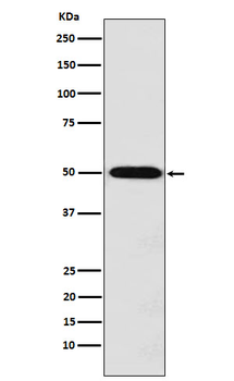 MCT1 Recombinant Rabbit Monoclonal Antibody