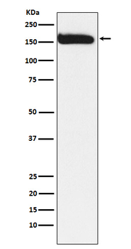 KAT13A Recombinant Rabbit Monoclonal Antibody
