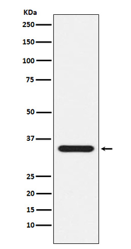 Presenilin 1 Recombinant Rabbit Monoclonal Antibody