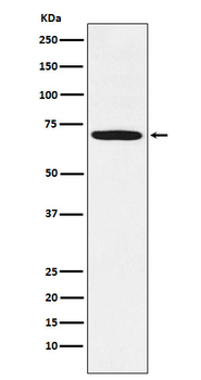 LIMK1 Recombinant Rabbit Monoclonal Antibody