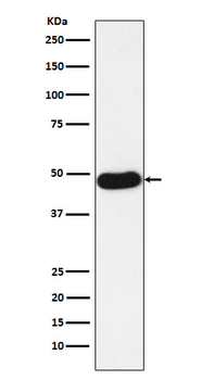 NAPSIN A Recombinant Rabbit Monoclonal Antibody