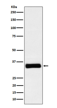 IGFBP2 Recombinant Rabbit Monoclonal Antibody