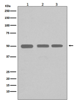 Beta I Tubulin Recombinant Rabbit Monoclonal Antibody