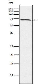 MELK Recombinant Rabbit Monoclonal Antibody