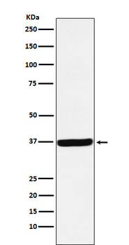 DDAH1 Recombinant Rabbit Monoclonal Antibody
