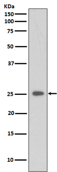 CRP Recombinant Rabbit Monoclonal Antibody
