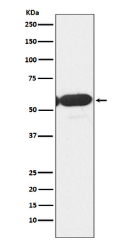 PFKFB3/PFK2 Recombinant Rabbit Monoclonal Antibody
